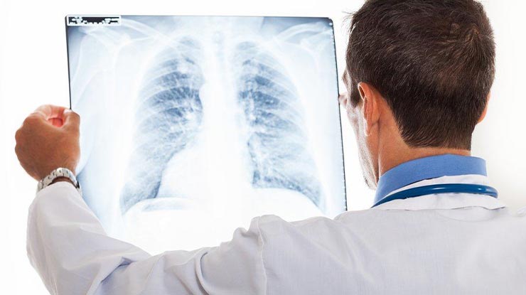 Update Terbaru Biaya Pemeriksaan Rontgen Thorax di Biotest